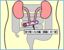 違いは何ですか?